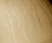 How can you reduce stretch marks quickly yourself?