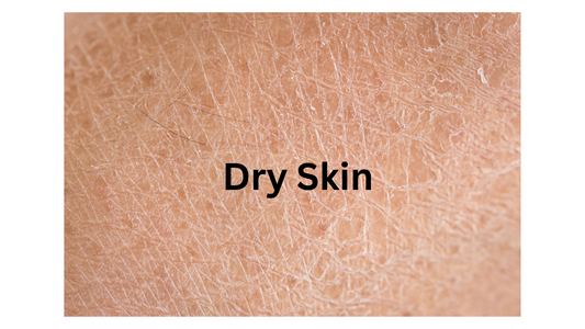 Dry skin