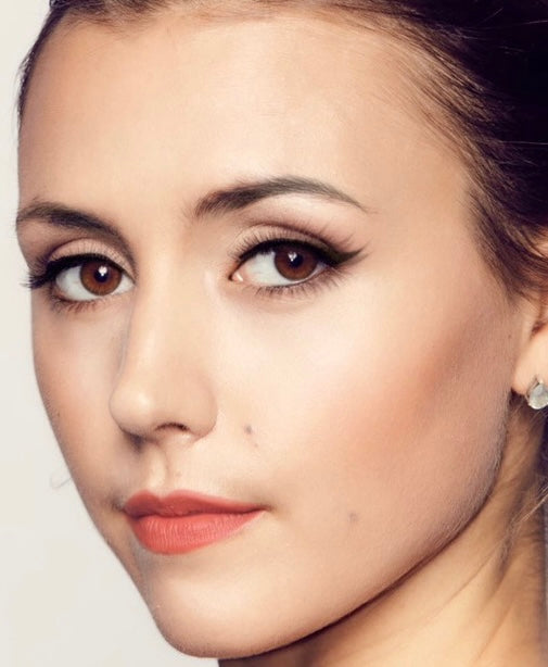 Skin Cancers Precancers, Prevention and Keeping them at bay